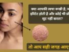 Rukhi or Sensitive Skin ke liye Skin Care Routine